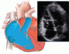 A young man with an unusual cause of palpitations
